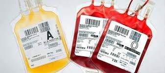 plasma
