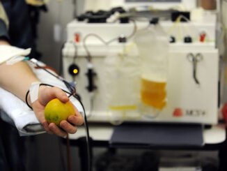 avis e plasma radio laser news matera potenza puglia basilicata