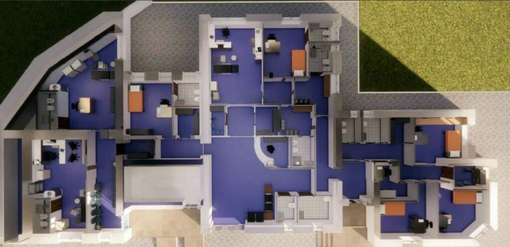 vista 3d ospedale stigliano radiolaser news matera potenza puglia basilicata