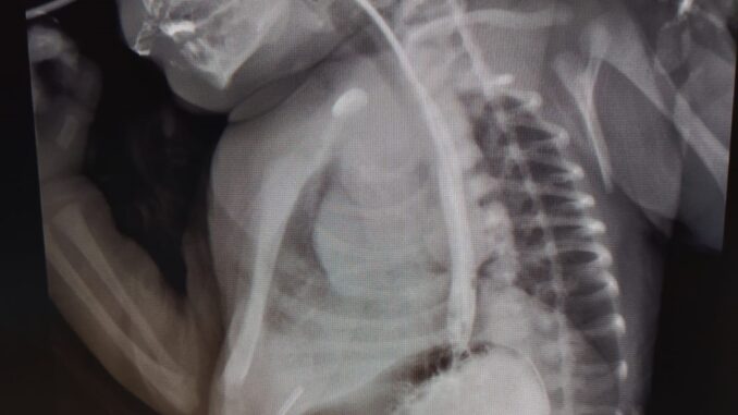chirurgia_pediatrica