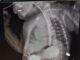 chirurgia pediatrica radio laser news matera potenza puglia basilicata